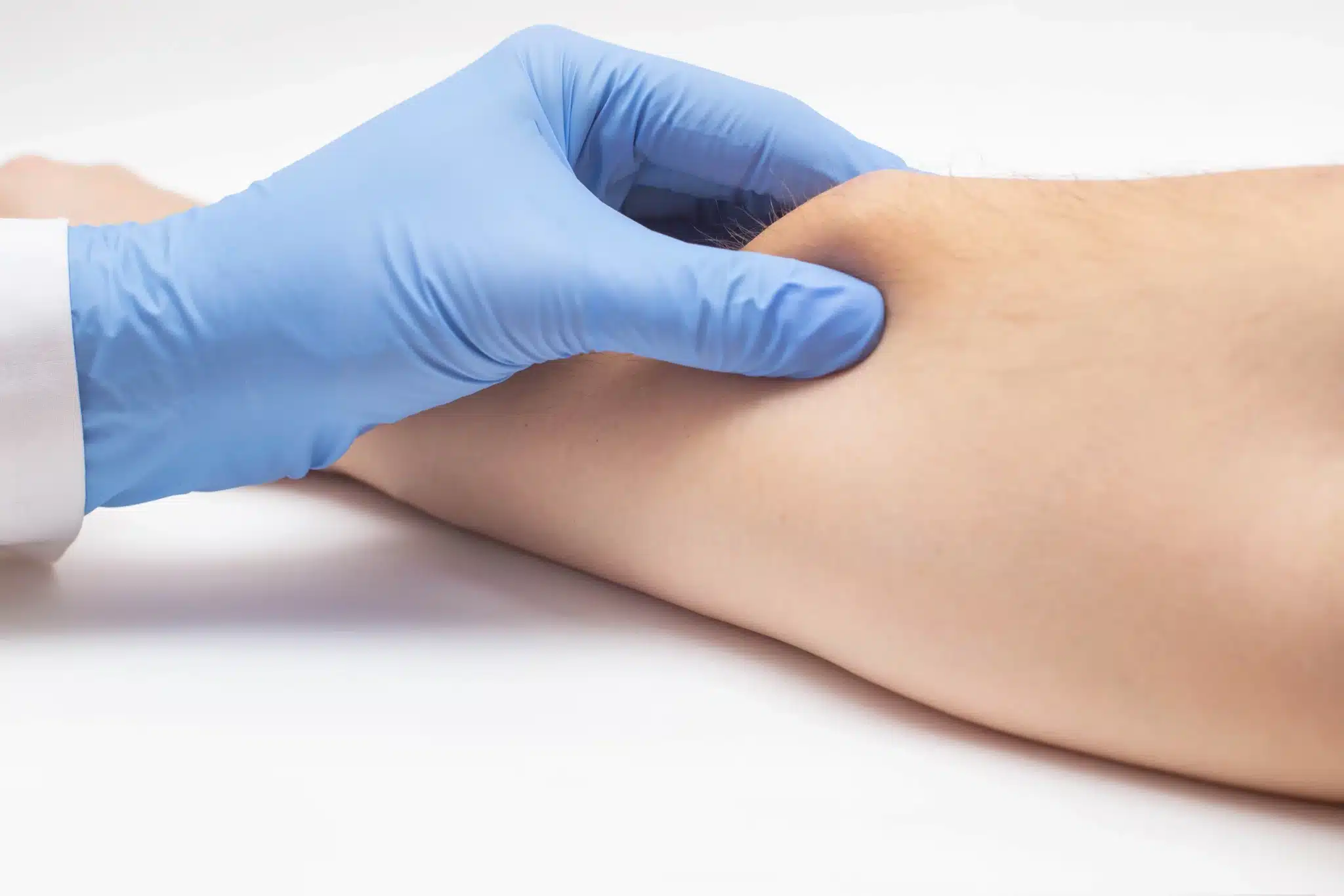 lipoma on arm being examined